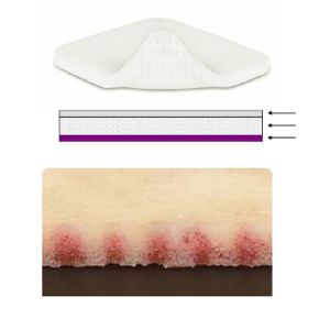 Molnlycke Mepilex XT Foam Dressing With Safetac Size 10x10cm